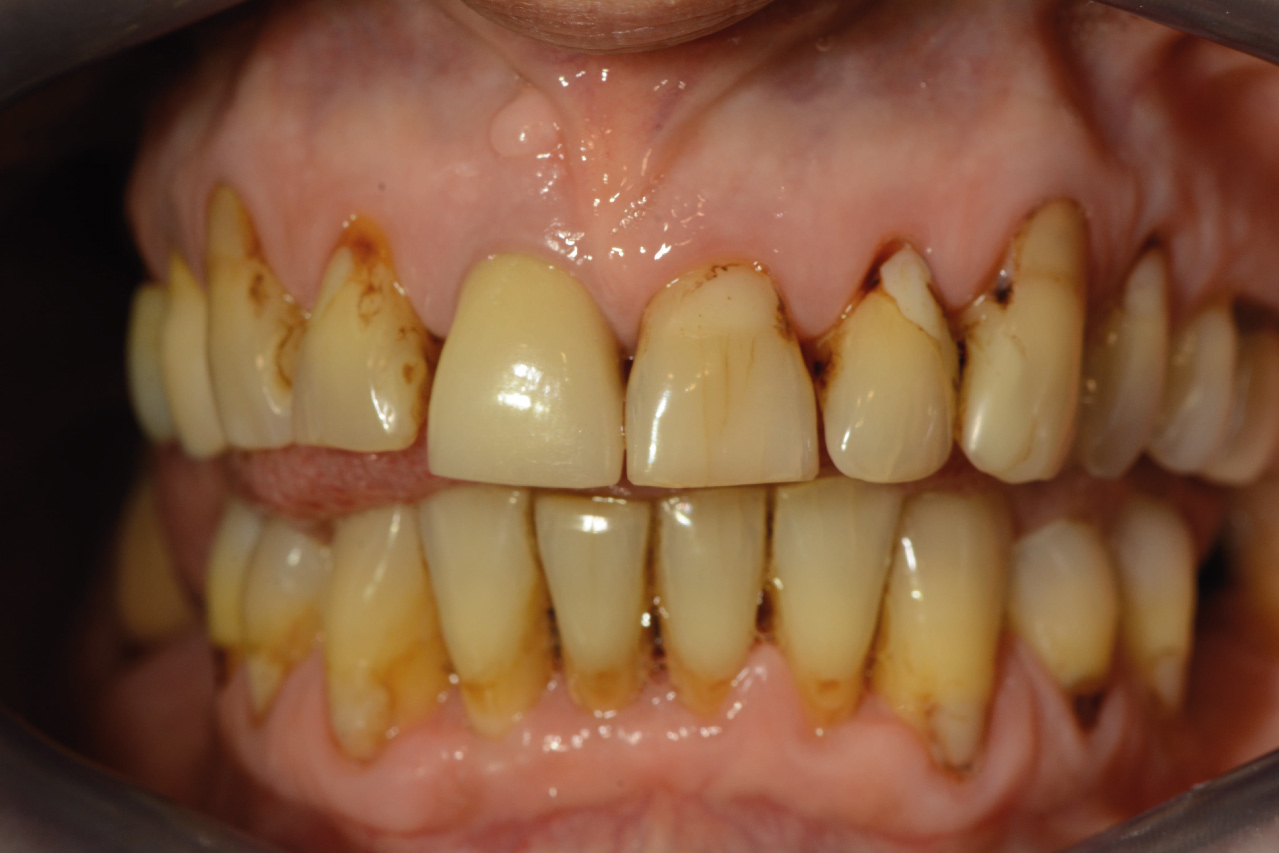 Before image
