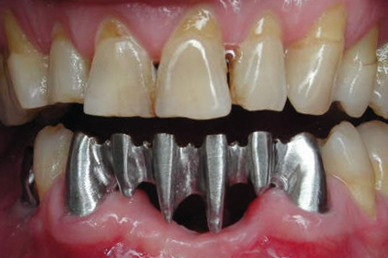 Before image
