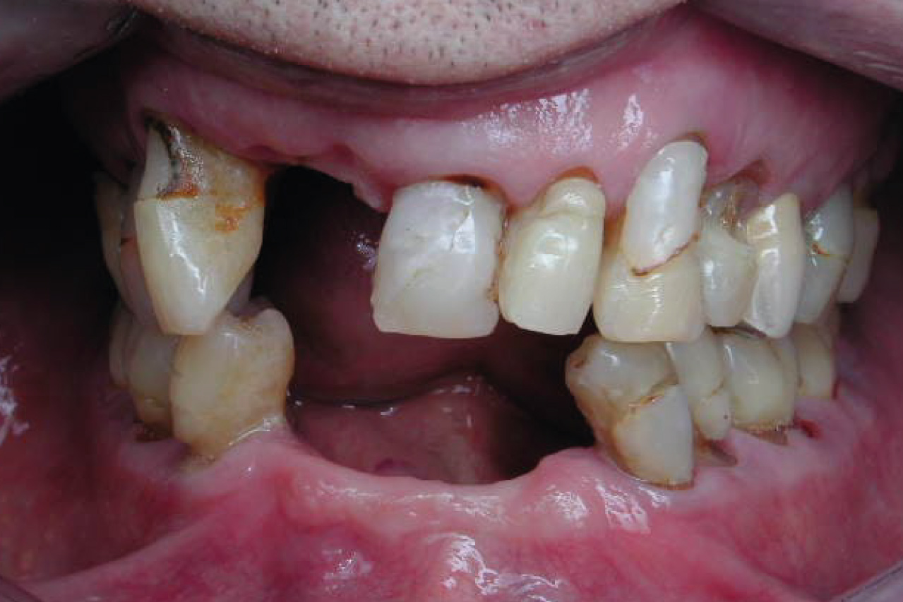 Before image
