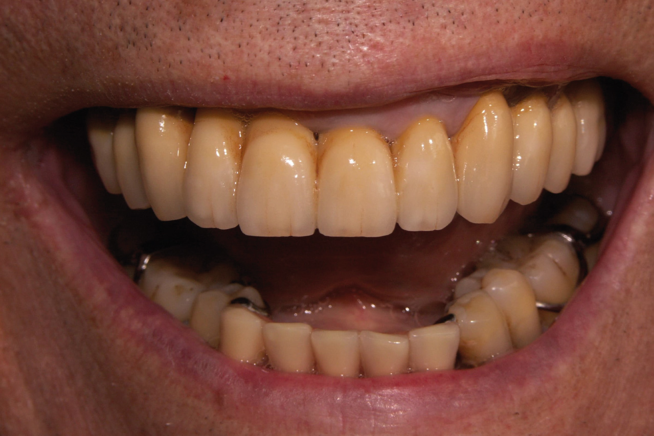 After image