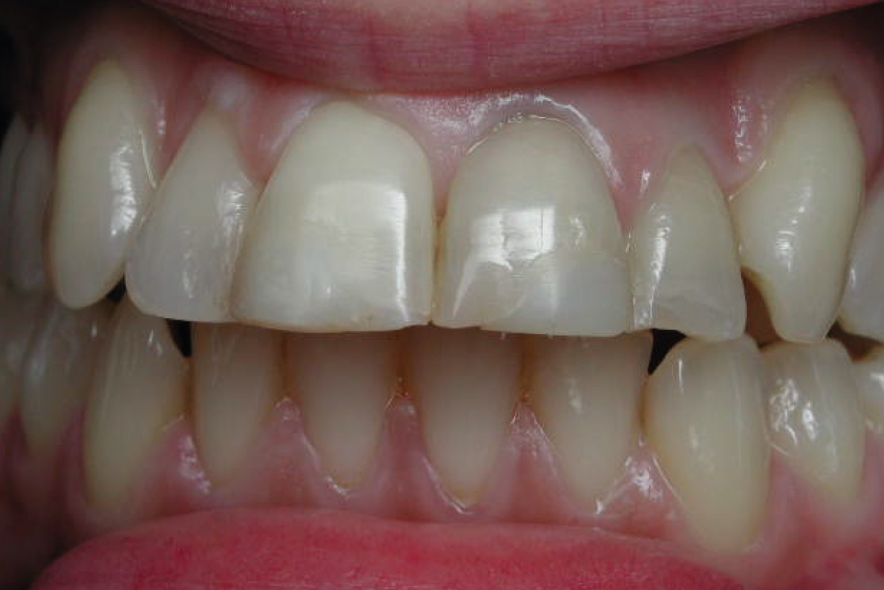 Before image