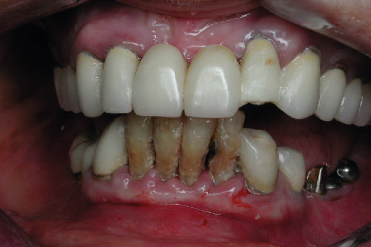 Before image