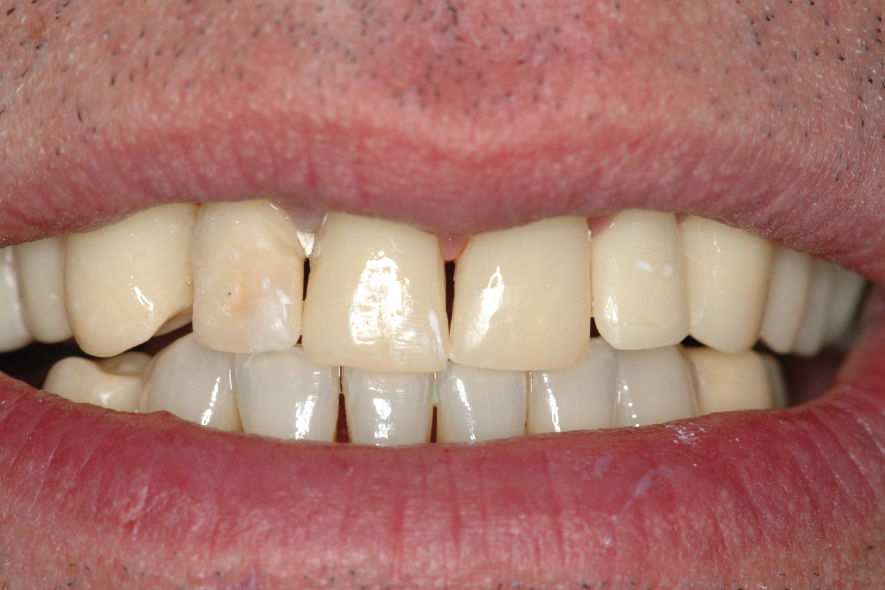 Before image