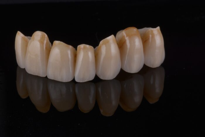 Lot De 8 Piquets En Céramique Pour Four De Laboratoire Dentaire - Pour Couronnes & Ponts