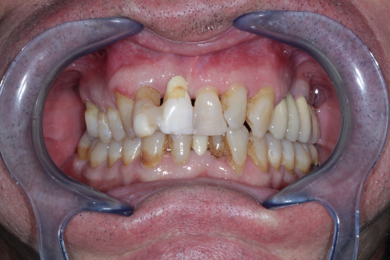 Before image