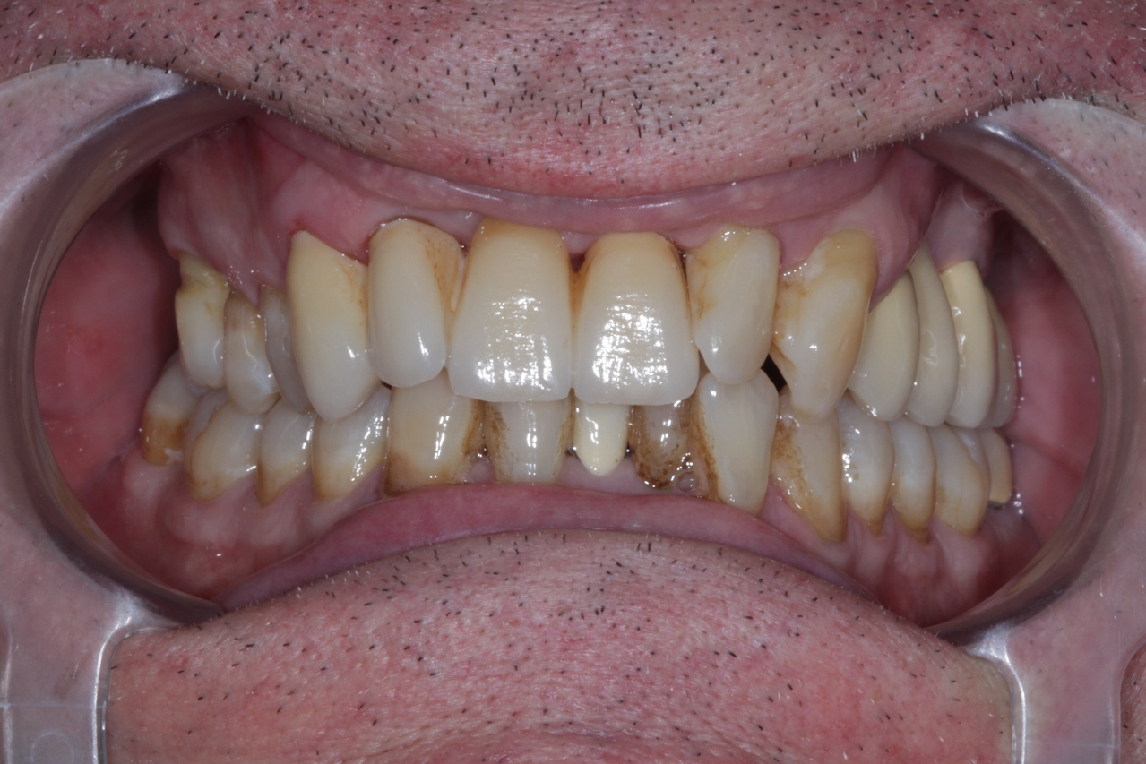 After image