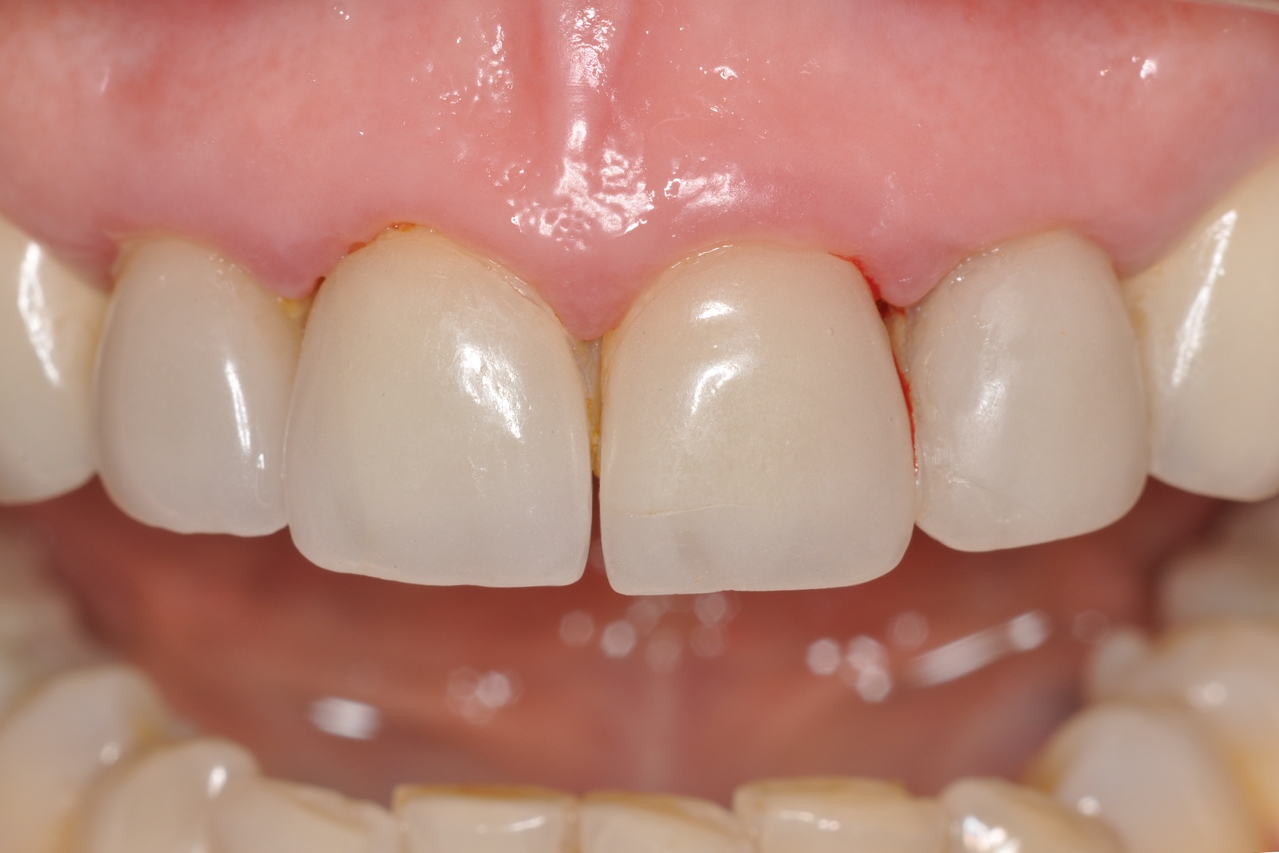 Before image
