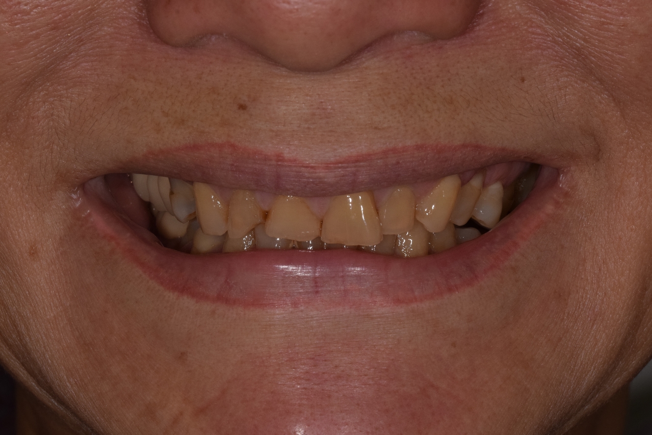 Before image