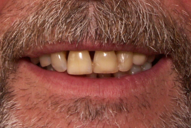 Before image