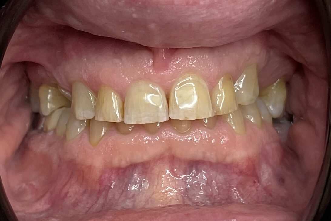 Before image